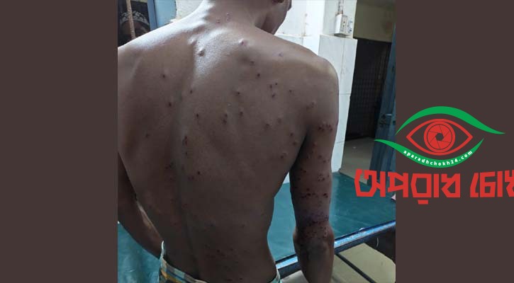 বিএসএফের গুলিতে বাংলাদেশি আহত