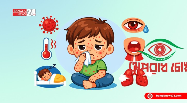 হামের উপসর্গে তিনজনের মৃত্যু