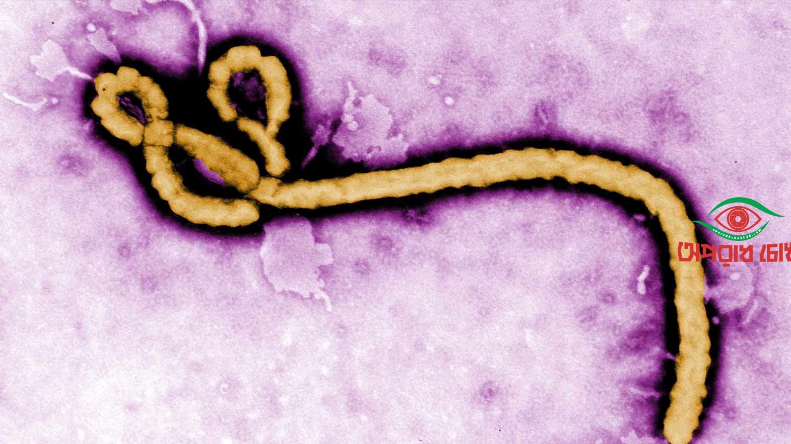 ইবোলা প্রাদুর্ভাবকে বৈশ্বিক জরুরি অবস্থা ঘোষণা