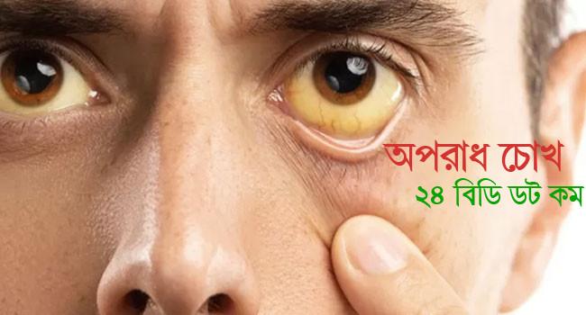 চোখ দেখেই রোগ নির্ণয়!